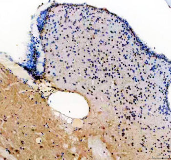 IHC staining of zebrafish Her4 protein using Zebrafish Her4 antibody, HRP-labeled secondary and DAB 