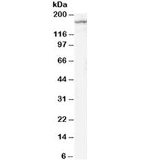 Western blot testing of rat brain lysate with NR2B antibody at 2ug/ml. Predicted molecular weight ~1