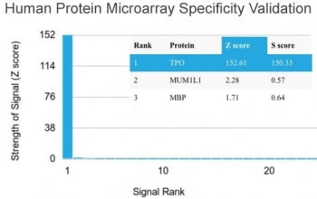 Thyroid Peroxidase Antibody