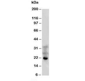 Western blot testing of FGF4 antibody and human HeLa cell lysate. Predicted molecular weight ~22 kDa