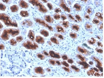 MUC1 Antibody / Mucin-1