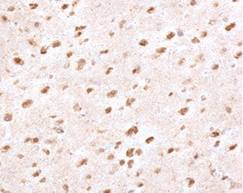 IHC staining of FFPE human brain with Ubiquitin antibody (clone PBQN-1). Required HIER: boil tissue 