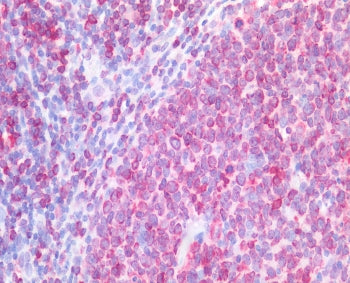 IHC staining of FFPE human tonsil tissue with CD74 antibody at 5ug/ml. Required HIER: steamed antige