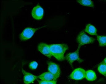 MEK3 Antibody / MAP2K3 / MKK3
