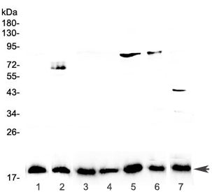 Western blot testing of 1) placenta, 2) PANC-1, 3) rat lymph, 4) rat small intestine, 5) rat testis,