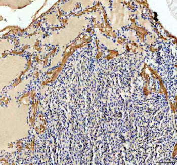 IHC staining of FFPE zebrafish brain tissue with Zebrafish Ckb antibody, HRP secondary and DAB subst