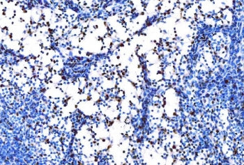 IHC staining of FFPE rat lymph gland tissue with SPI1 antibody. HIER: boil tissue sections in pH8 ED