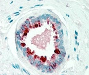 IHC staining of FFPE human breast with GCDFP-15 antibody at 2.5ug/ml. HIER: steamed with pH6 citrate