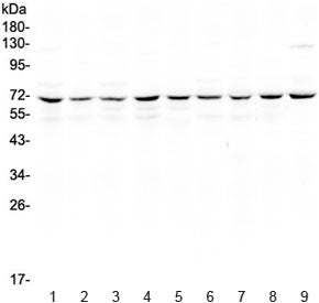 Western blot testing of human 1) HeLa, 2) Jurkat, 3) MCF7, 4) COLO320, 5) U-87 MG, 6) A549, 7) rat t