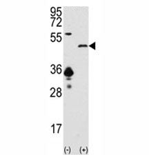 Western blot analysis of SIRT7 antibody and 293 cell lysate (2 ug/lane) either nontransfected (Lane 