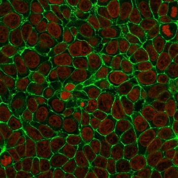 EpCAM Antibody