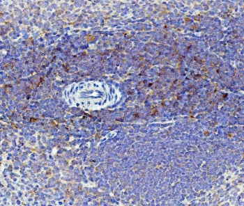 IHC staining of FFPE rat spleen with Cd59 antibody. HIER: boil tissue sections in pH8 EDTA for 20 mi