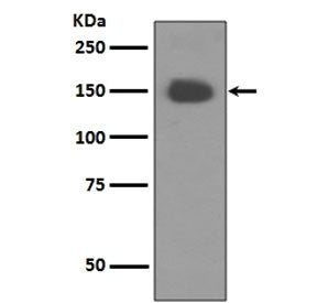 Western blot testing of human fetal brain lysate with NTRK1 antibody. Expected molecular weight: 85~