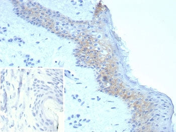 Desmoglein 3 Antibody / DSG3