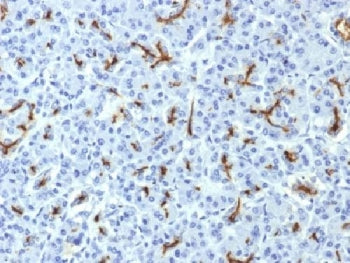 CFTR Antibody / Cystic Fibrosis Transmembrane Regulator
