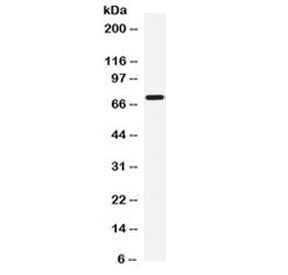 IL12RB1 Antibody / CD212