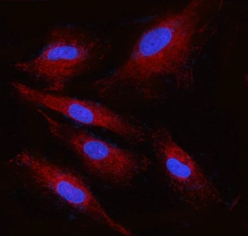 Ribophorin II Antibody / RPN2