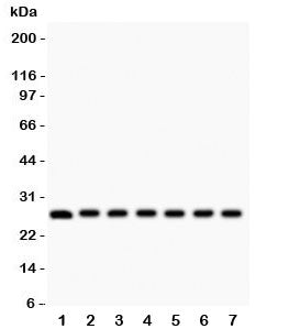Western blot testing of Galectin 3 antibody and mouse samples 1: kidney; 2: liver; 3: spleen; 4: ova