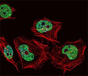 Fluorescent confocal image of human HeLa cell stained with CUX1 antibody. HeLa cells were fixed with