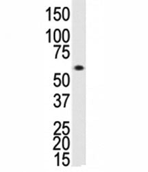 Western blot analysis of ALK3 antibody and human Saos-2 cell lysate. Predicted molecular weight ~60 