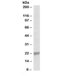 Western blot testing of rat liver lysate with Gpx1 antibody at 0.1g/ml. Predicted molecular weight ~