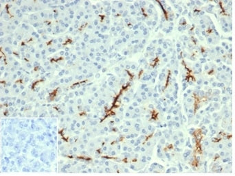 CFTR Antibody / Cystic Fibrosis Transmembrane Regulator