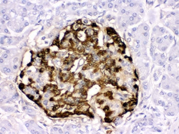 GLP-1 Antibody / Glucagon-like peptide 1