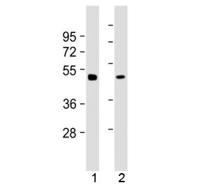 Western blot testing of mouse 1) brain and 2) liver tissue lysate with Gamma Tubulin antibody at 1:2