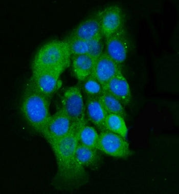 ILK Antibody / Integrin linked kinase