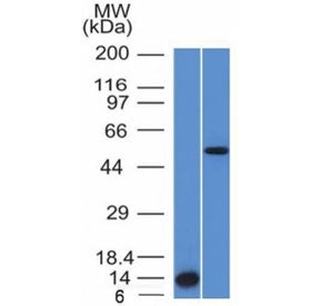 Western blot testing (A) recombinant protein and (B) human HepG2 cell lysate using Anaplastic Lympho