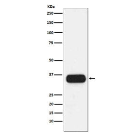 Western blot testing of human spleen lysate with HLA-DQA1 antibody. Expected molecular weight ~34 kD