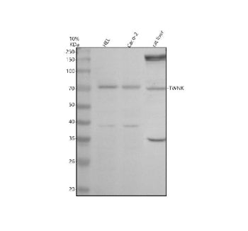 Western blot analysis of Twinkle/TWNK using anti-TWNK antibody. Electrophoresis was performed on a 1