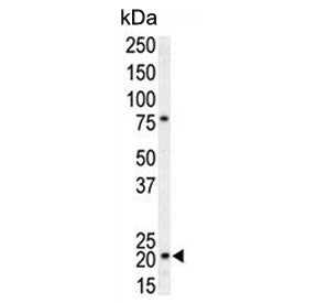 Western blot testing of human T-47D cell lysate with p21WAF1 antibody. Expected molecular weight: 18