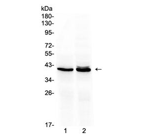 Western blot testing of 1) rat liver and 2) mouse liver lysate with OTC antibody at 0.5ug/ml. Predic