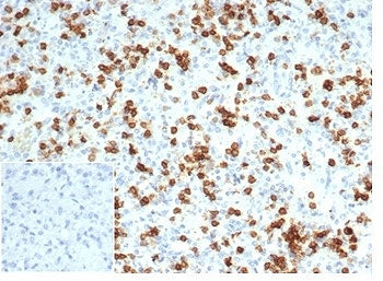 IHC staining of FFPE human spleen tissue with recombinant CD6 antibody (clone C6/7022R) at 2ug/ml in