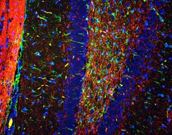 Immunofluorescent staining of FFPE rat brain tissue with GFAP antibody (green), MBP antibody (red) a