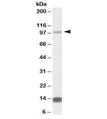 Western blot testing of NIH3T3 lysate with TRIM71 antibody at 0.5ug/ml. Predicted molecular weight: 