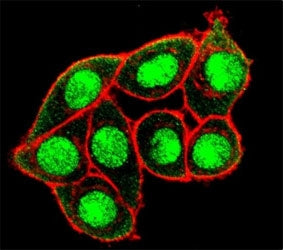 Confocal immunofluorescent analysis of phospho-MUC1 antibody and HeLa cells followed by Alexa Fluor 