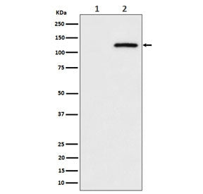 CBL Antibody / Casitas B-lineage lymphoma proto-oncogene (pS669)