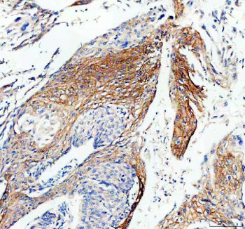 Immunofluorescent staining of FFPE human U-2 OS cells with Connexin 43 antibody (green) and DAPI (bl