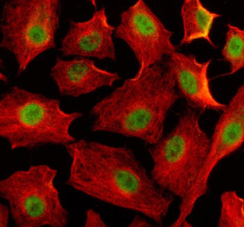 Immunofluorescent staining of EIF4A3 using anti-EIF4A3 antibody (green) and anti-Beta Tubulin antibo