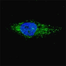 LC3A Antibody / MAP1LC3A, 0.08ml