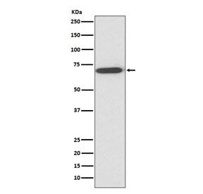 Western blot testing of human fetal liver lysate with Perilipin 1 antibody at 0.5ug/ml. Expected mol