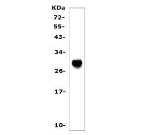 SAP Antibody (Serum Amyloid P)