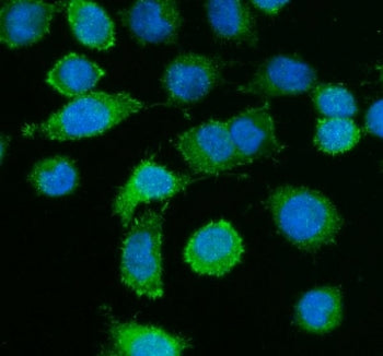 Caldesmon / CAD Antibody