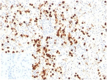 LYZ Antibody / Lysozyme C