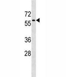 AMPK Antibody (PRKAA1)
