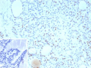 IHC staining of FFPE human thyroid tissue with TTF-1 antibody (clone NX2.1/9035). Inset: PBS used in