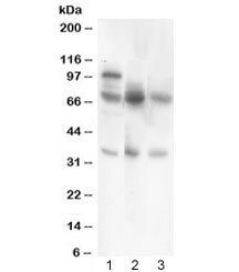 Western blot testing of GAD67 antibody and Lane 1: rat testis; 2: mouse brain; 3: human MCF7 lysate.