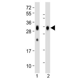 Western blot testing of human 1) spleen and 2) placenta lysate with Folate Receptor beta antibody at